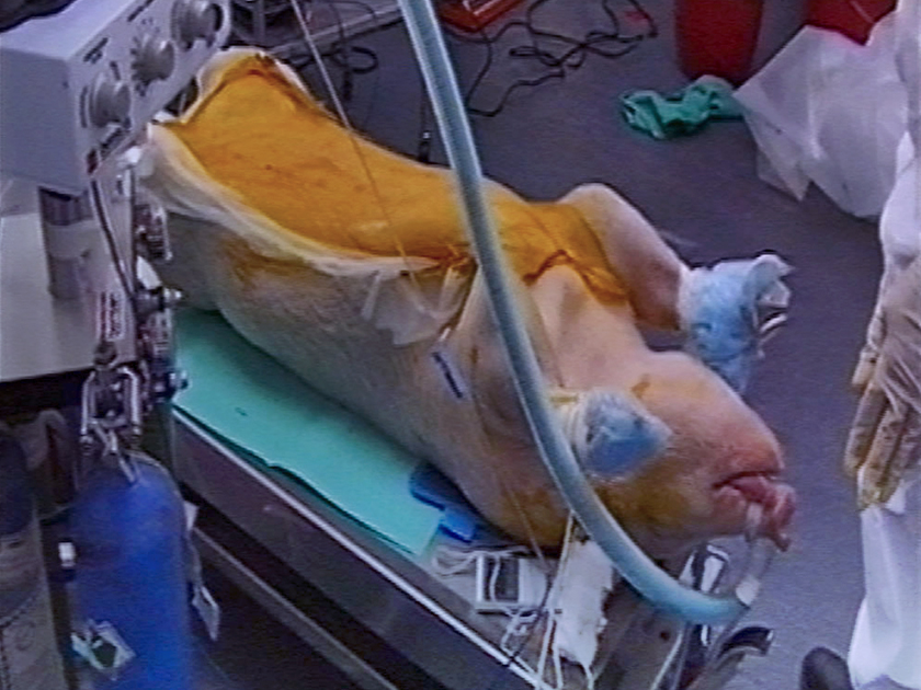 HLS xenotransplant tests stitch pig hearts to the necks of monkeys